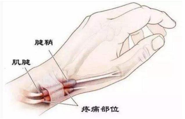 缓解80%妈妈们2.jpg